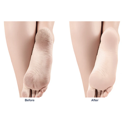 GRINDING FEET ARTIFACT EXFOLIATING NANO GLASS GRINDING STONE HOUSE FRUSTRATED FEET FOOT SCRAPING HEEL